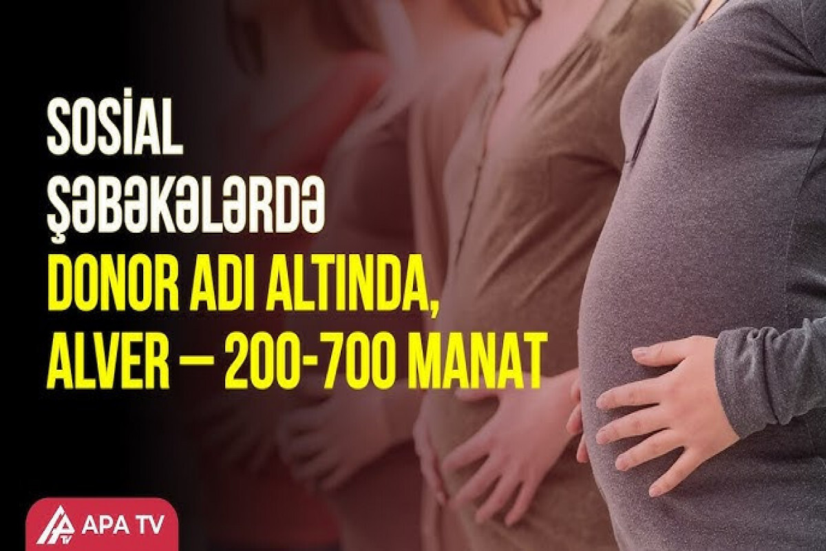 Follikul bağış Azerbaycan'daki herkesi yapabilir mi? - araştırma